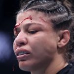 UFC: Mayra Bueno compartilha foto do ferimento adquirido no UFC 303 costurado