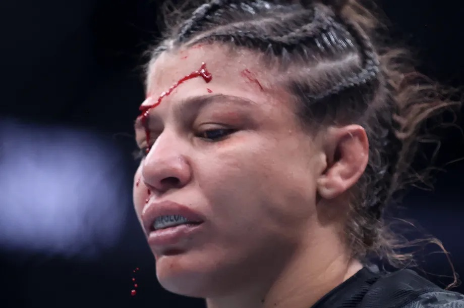 UFC: Mayra Bueno compartilha foto do ferimento adquirido no UFC 303 costurado