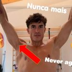 MÉDICO fala dessa FOTO do Marc MARQUEZ