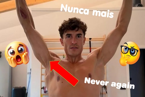MÉDICO fala dessa FOTO do Marc MARQUEZ